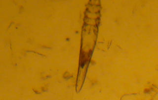 Demodex Haarbalgmilbe