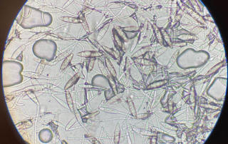 Makrokonidien Microsporum